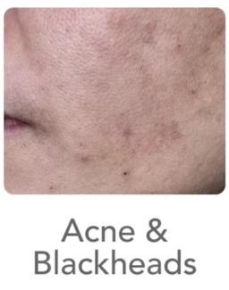 Dark Spots